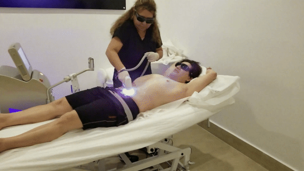 laser Hair Removal on a guy